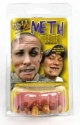 Picture of Billy Bob Meth Teeth 